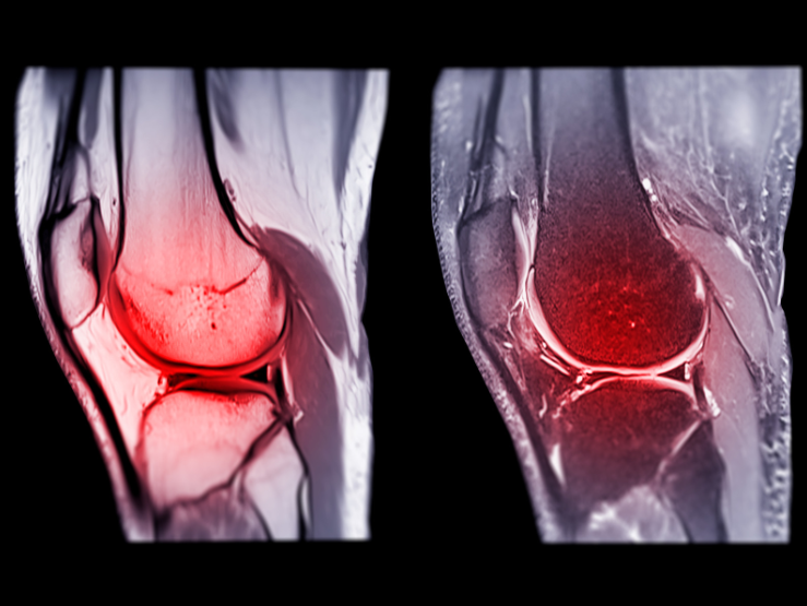 types of soft tissues